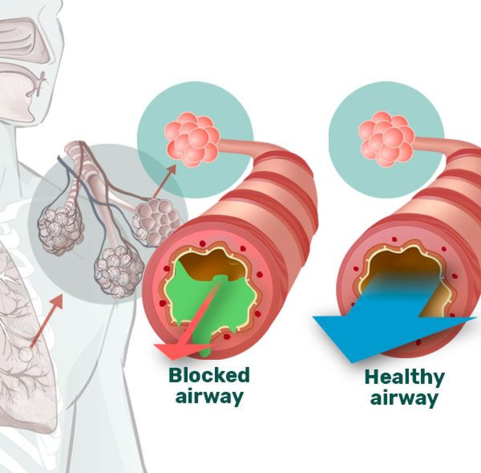 Is The Breather Device Any Good? [2024 Review] 